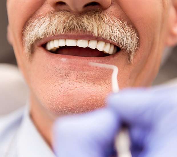 Great Falls Adjusting to New Dentures