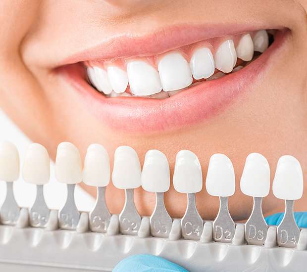 Great Falls Cosmetic Dentist