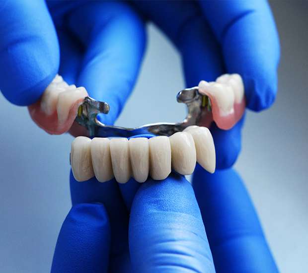 Great Falls Dental Bridges