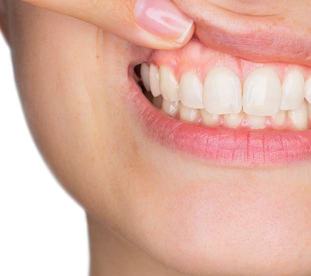Great Falls Gum Disease