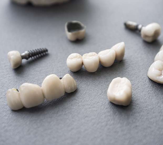 Great Falls The Difference Between Dental Implants and Mini Dental Implants