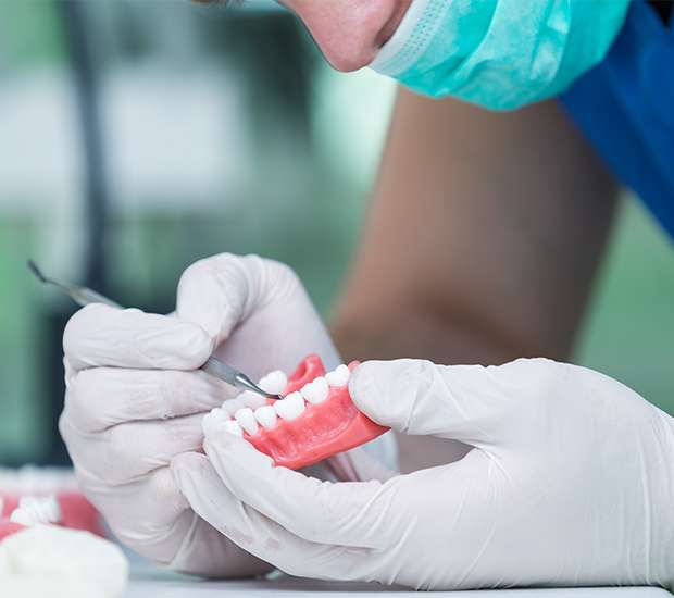 Great Falls Partial Denture for One Missing Tooth