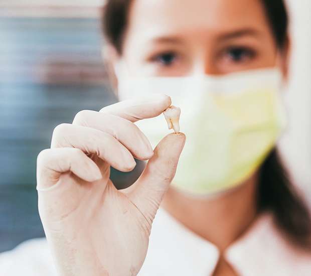 Great Falls Tooth Extraction