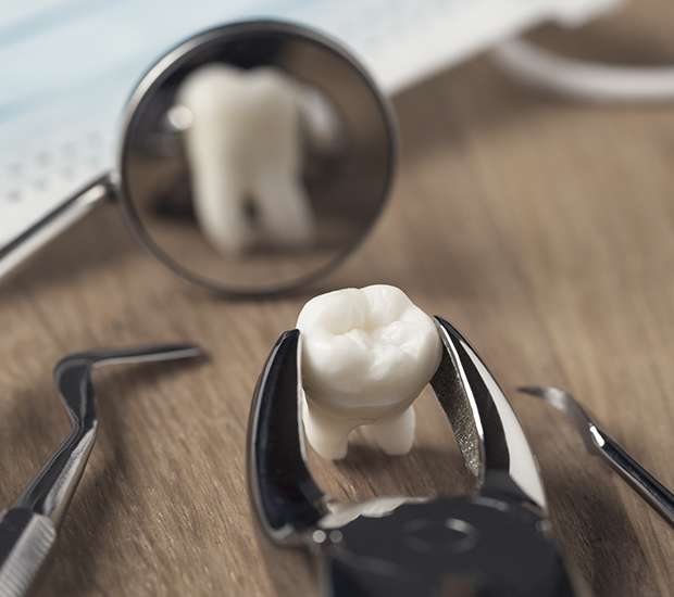 Great Falls When Is a Tooth Extraction Necessary